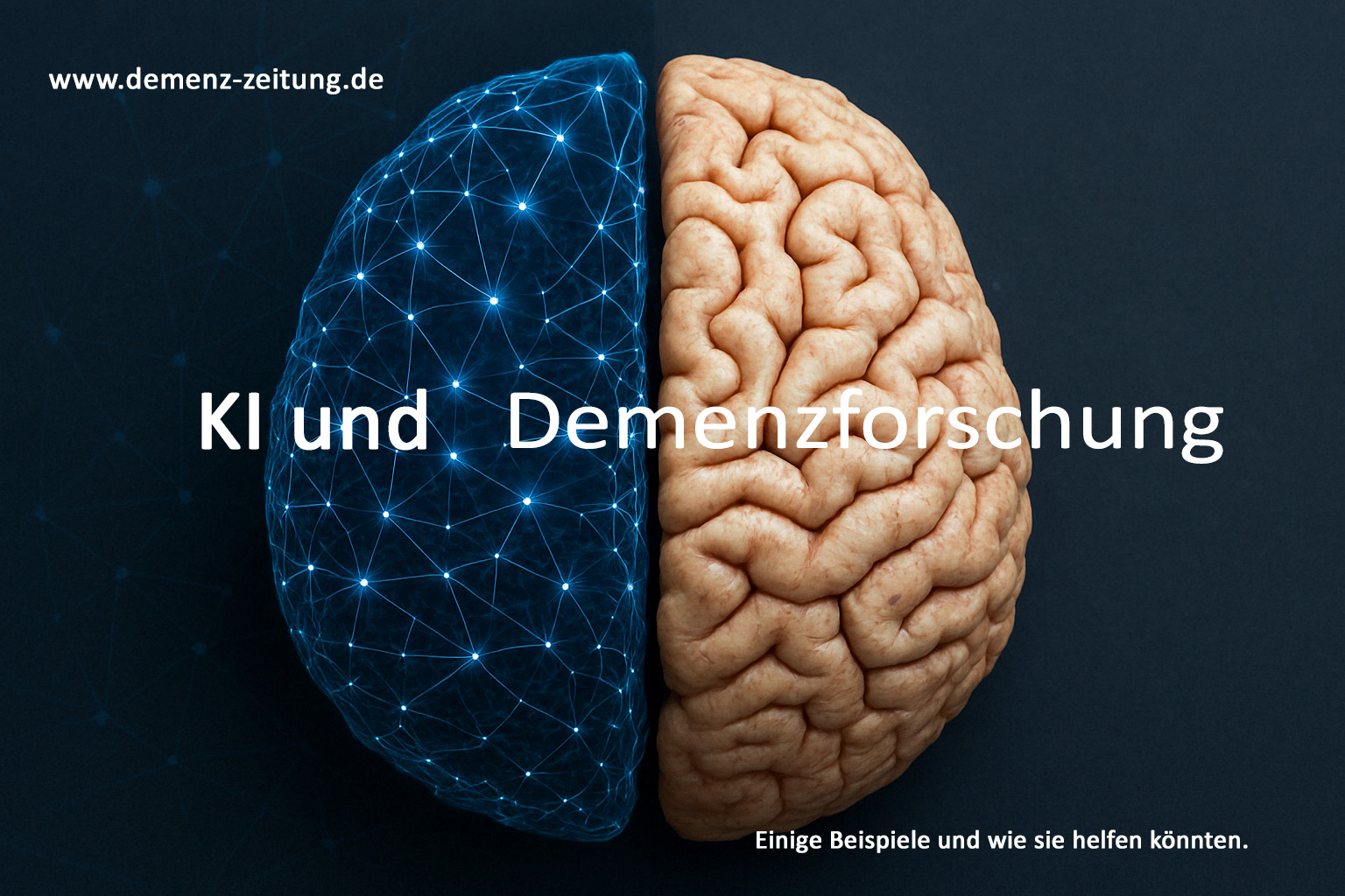 Wie Künstliche Intelligenz der Alzheimerforschung dient